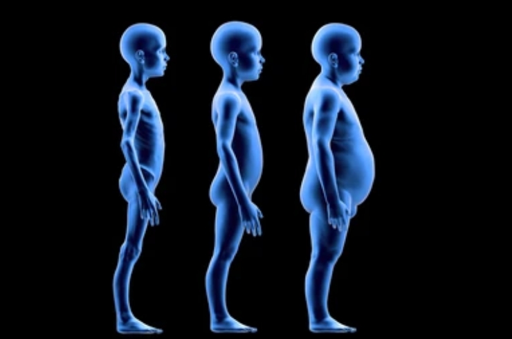 Apatarpanajanya Vyadhi(Disorders Due to Undernourishment)